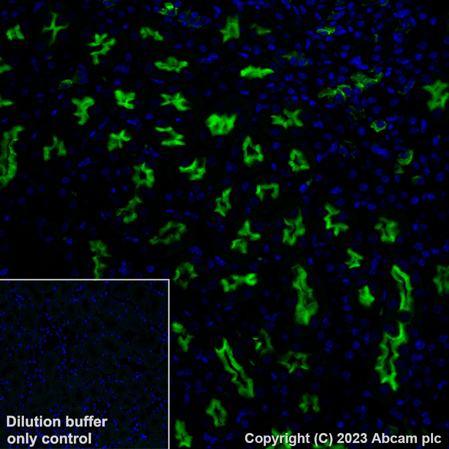 Immunohistochemistry (Formalin/PFA-fixed paraffin-embedded sections) - Alexa Fluor® 488 Anti-CD10 antibody [EPR22867-118] (AB308601), expandable thumbnail