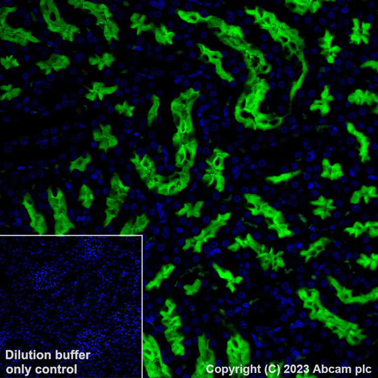 Immunohistochemistry (Formalin/PFA-fixed paraffin-embedded sections) - Alexa Fluor® 488 Anti-CD10 antibody [EPR22867-118] (AB308601)