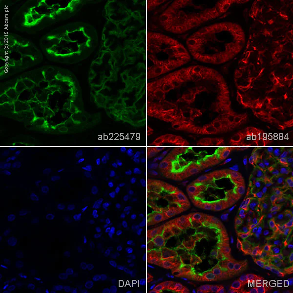 Immunohistochemistry (Formalin/PFA-fixed paraffin-embedded sections) - Alexa Fluor® 488 Anti-CD10 antibody [EPR5904-110] (AB225479)