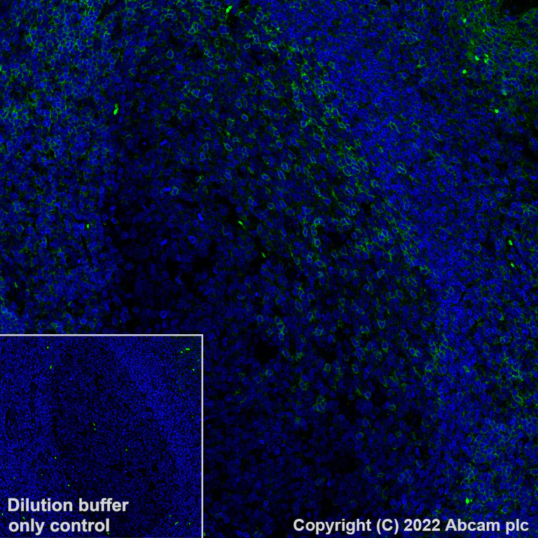 Immunohistochemistry (Formalin/PFA-fixed paraffin-embedded sections) - Alexa Fluor® 488 Anti-CD11a antibody [EP1285Y] (AB307764)