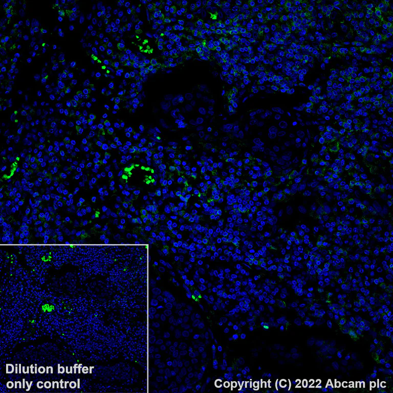 Immunohistochemistry (Formalin/PFA-fixed paraffin-embedded sections) - Alexa Fluor® 488 Anti-CD11a antibody [EP1285Y] (AB307764)