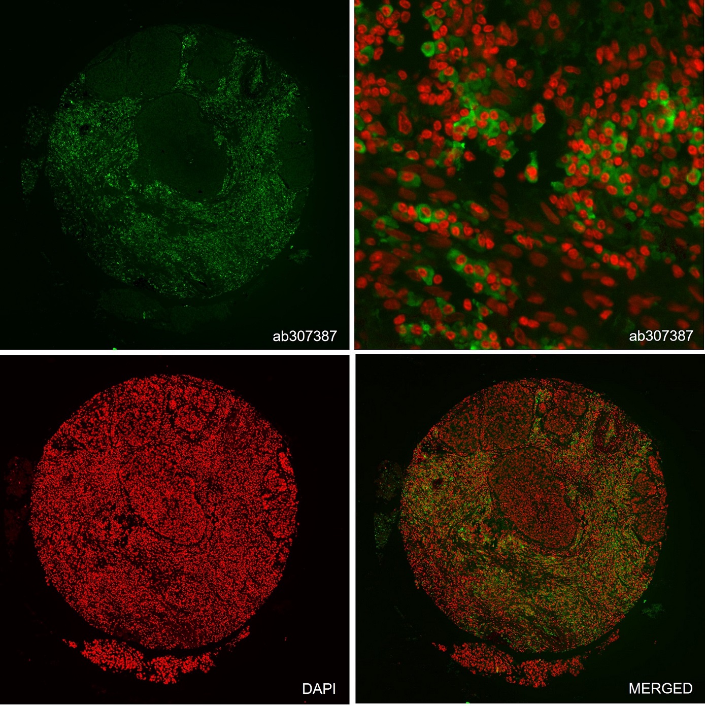 Multiplex immunohistochemistry - Alexa Fluor® 488 Anti-CD11b antibody [EPR1344] (AB307387), expandable thumbnail