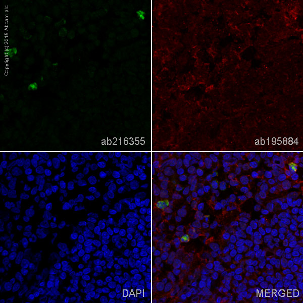 Immunohistochemistry (Frozen sections) - Alexa Fluor® 488 Anti-CD11b + CD11c antibody [OX42] (AB216355), expandable thumbnail