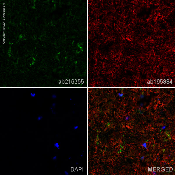 Immunohistochemistry (Frozen sections) - Alexa Fluor® 488 Anti-CD11b + CD11c antibody [OX42] (AB216355), expandable thumbnail