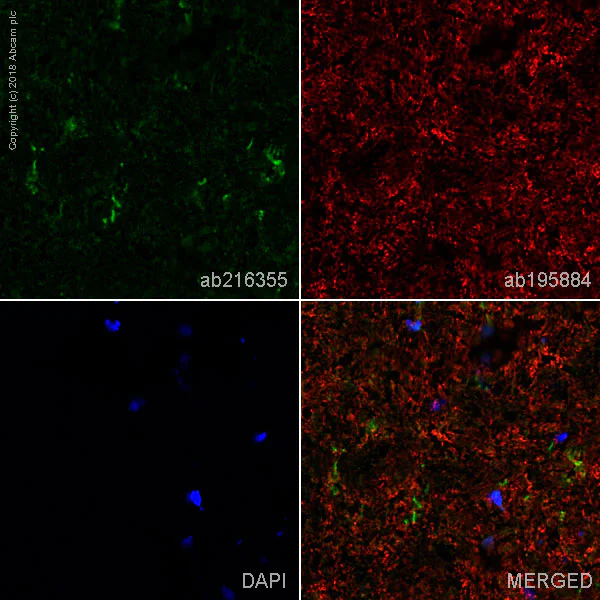 Immunohistochemistry (Frozen sections) - Alexa Fluor® 488 Anti-CD11b + CD11c antibody [OX42] (AB216355)