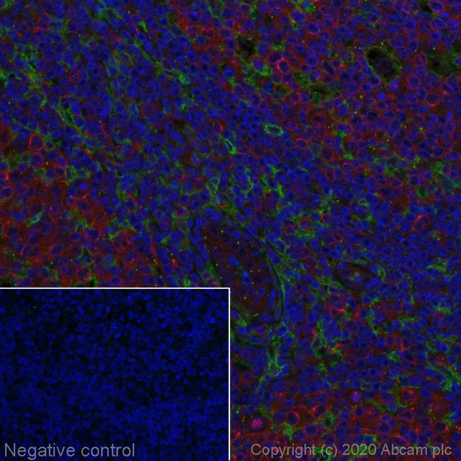 Immunohistochemistry (Formalin/PFA-fixed paraffin-embedded sections) - Alexa Fluor® 488 Anti-CD11c antibody [EP1347Y] (AB275738), expandable thumbnail