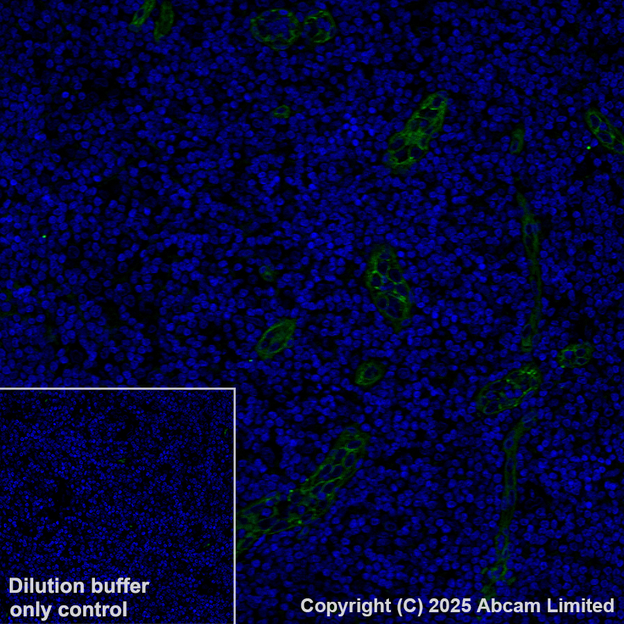 Immunohistochemistry (Formalin/PFA-fixed paraffin-embedded sections) - Alexa Fluor® 488 Anti-CD146 antibody [EPR3208] (AB196448)