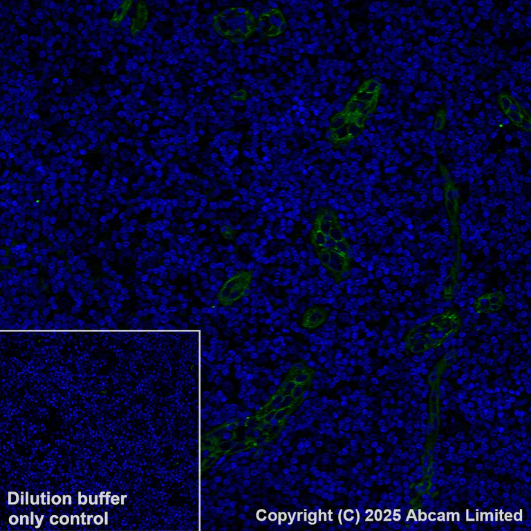 Immunohistochemistry (Formalin/PFA-fixed paraffin-embedded sections) - Alexa Fluor® 488 Anti-CD146 antibody [EPR3208] (AB196448)