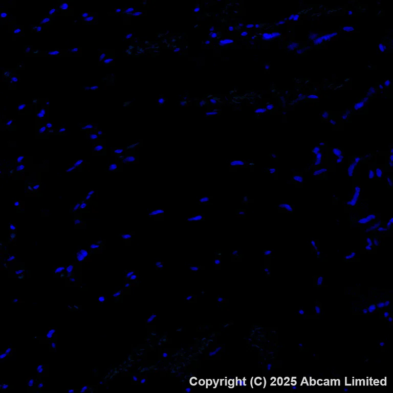 Immunohistochemistry (Formalin/PFA-fixed paraffin-embedded sections) - Alexa Fluor® 488 Anti-CD146 antibody [EPR3208] (AB196448)