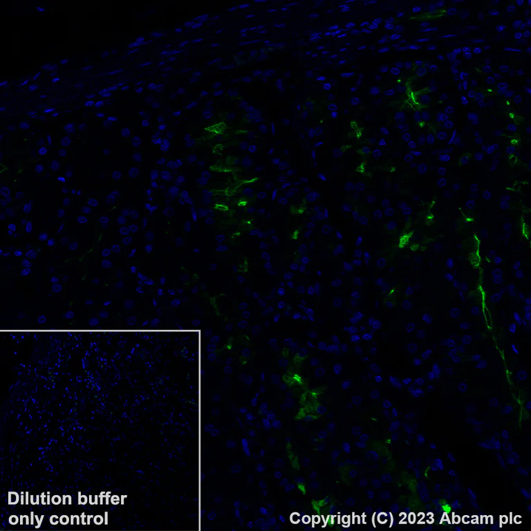 Immunohistochemistry (Formalin/PFA-fixed paraffin-embedded sections) - Alexa Fluor® 488 Anti-CD15 antibody [EPR9521] (AB313399)