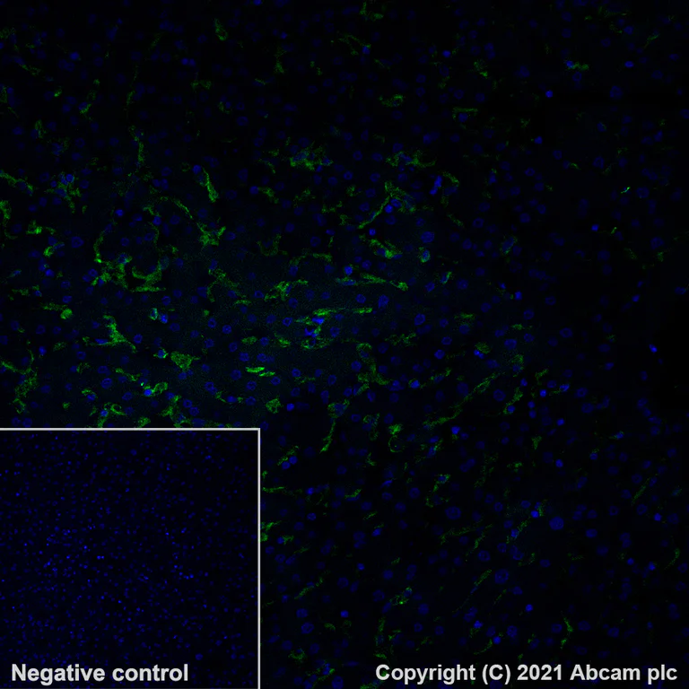 Immunohistochemistry (Formalin/PFA-fixed paraffin-embedded sections) - Alexa Fluor® 488 Anti-CD16 antibody [EPR16784] (AB282002)