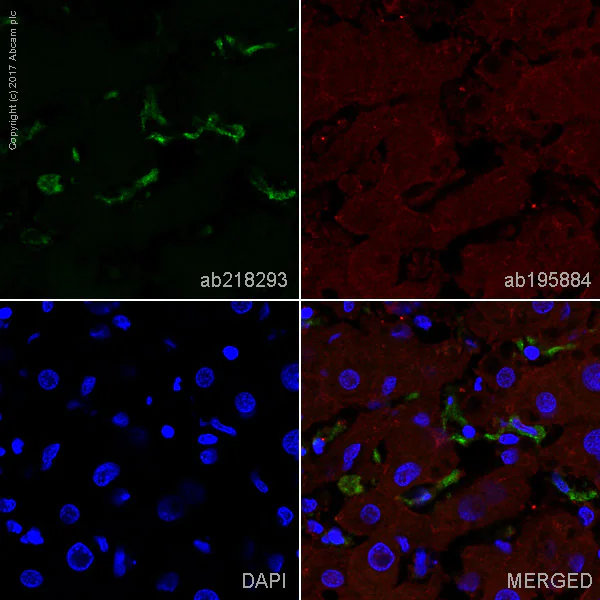 Immunohistochemistry (Frozen sections) - Alexa Fluor® 488 Anti-CD163 antibody [EPR14643-36] - C-terminal (AB218293)