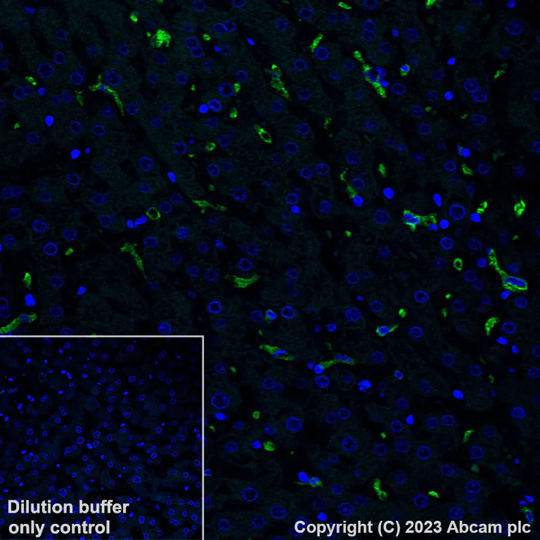 Immunohistochemistry (Formalin/PFA-fixed paraffin-embedded sections) - Alexa Fluor® 488 Anti-CD163 antibody [EPR19518] (AB313665)