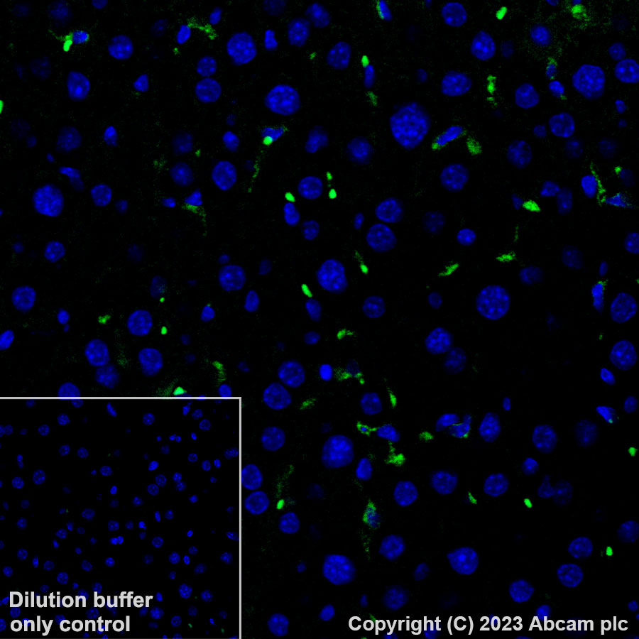 Immunohistochemistry (Formalin/PFA-fixed paraffin-embedded sections) - Alexa Fluor® 488 Anti-CD163 antibody [EPR19518] (AB313665), expandable thumbnail