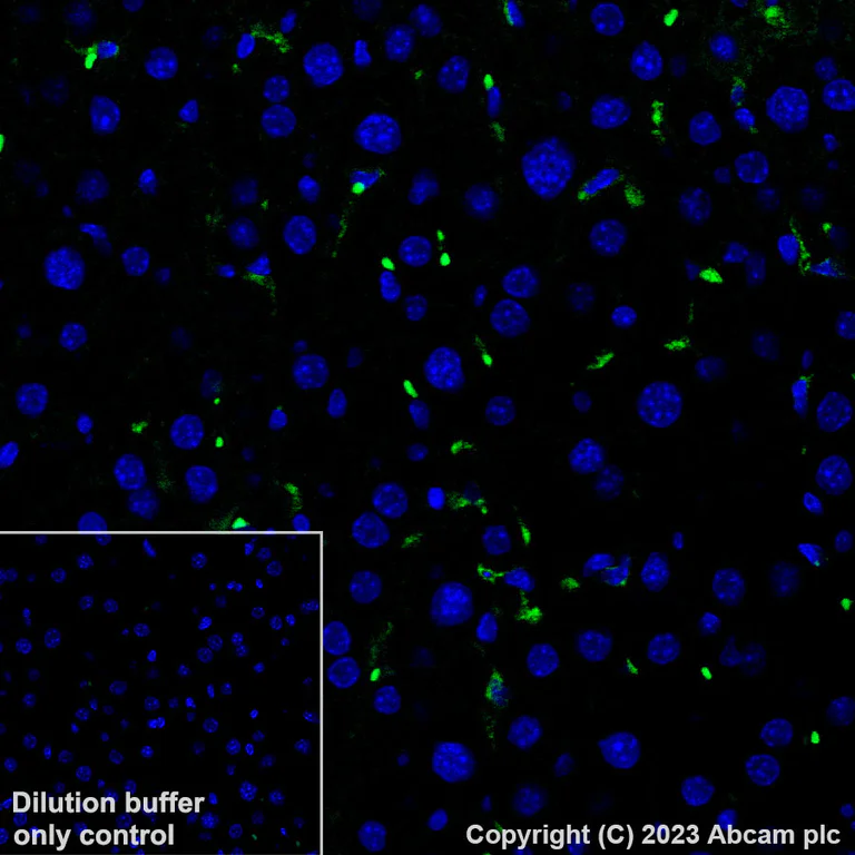 Immunohistochemistry (Formalin/PFA-fixed paraffin-embedded sections) - Alexa Fluor® 488 Anti-CD163 antibody [EPR19518] (AB313665)