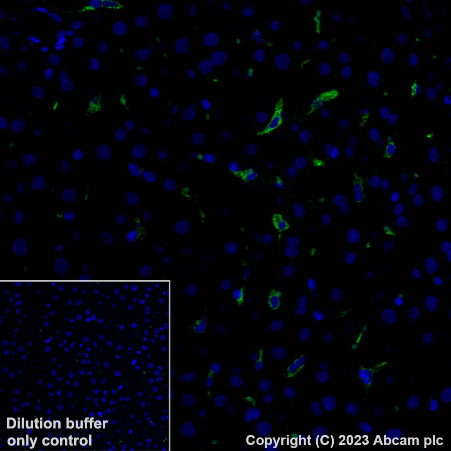 Immunohistochemistry (Formalin/PFA-fixed paraffin-embedded sections) - Alexa Fluor® 488 Anti-CD163 antibody [EPR19518] (AB313665), expandable thumbnail