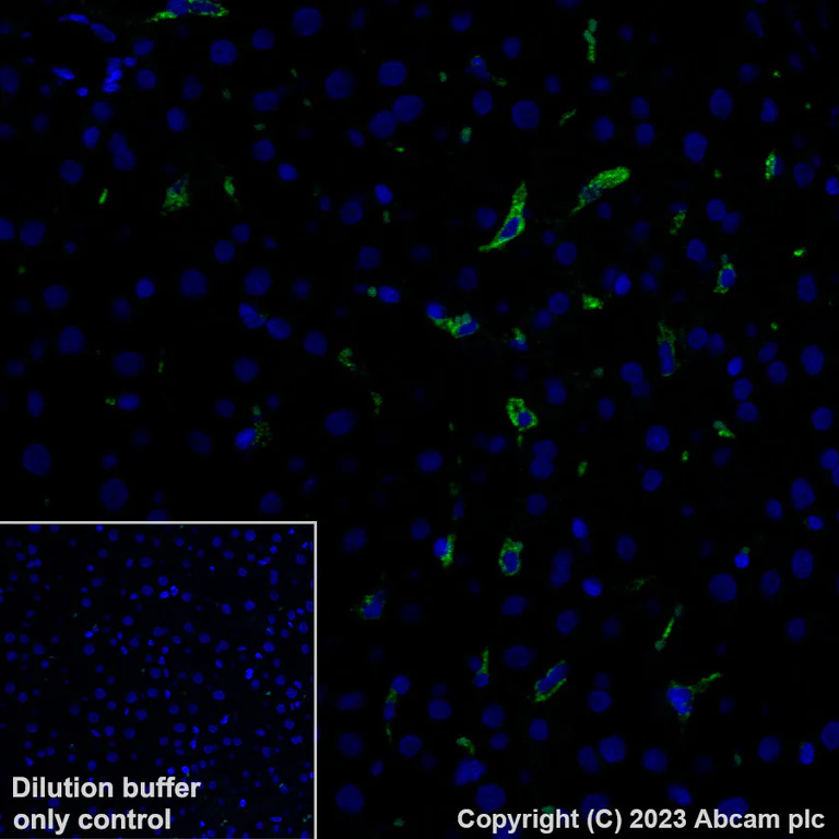 Immunohistochemistry (Formalin/PFA-fixed paraffin-embedded sections) - Alexa Fluor® 488 Anti-CD163 antibody [EPR19518] (AB313665)