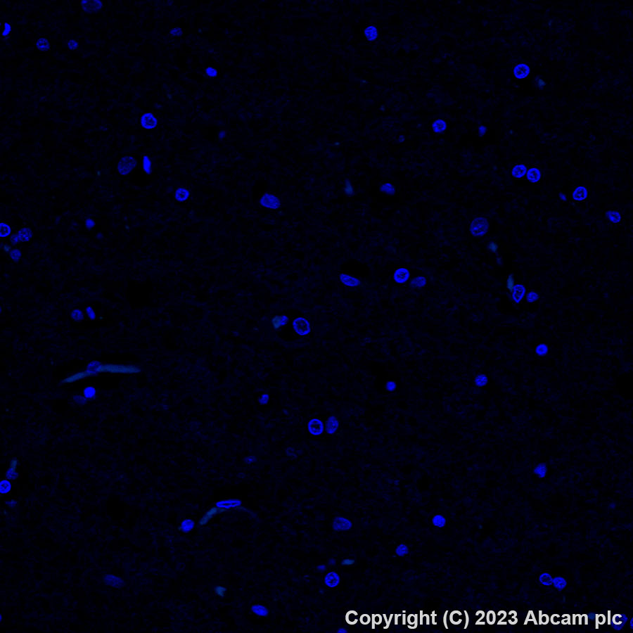 Immunohistochemistry (Formalin/PFA-fixed paraffin-embedded sections) - Alexa Fluor® 488 Anti-CD163 antibody [EPR19518] (AB313665), expandable thumbnail