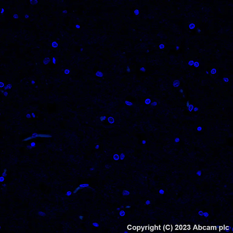 Immunohistochemistry (Formalin/PFA-fixed paraffin-embedded sections) - Alexa Fluor® 488 Anti-CD163 antibody [EPR19518] (AB313665)