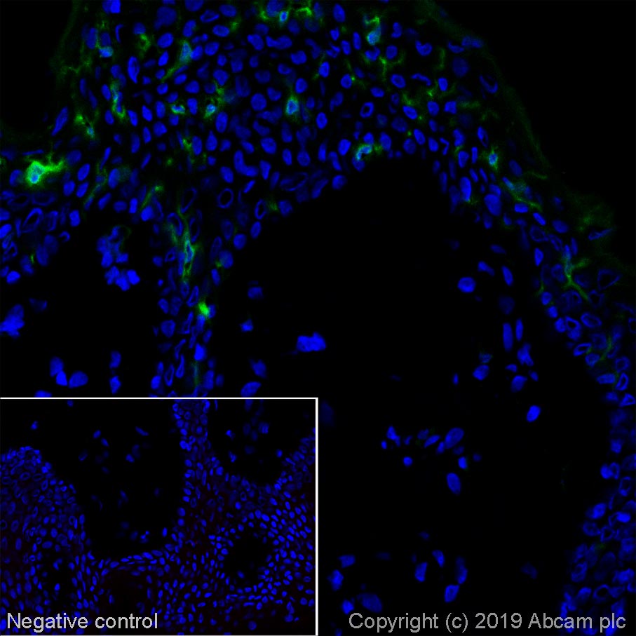 Immunohistochemistry (Frozen sections) - Alexa Fluor® 488 Anti-CD1a antibody [NA1/34] (AB256268), expandable thumbnail
