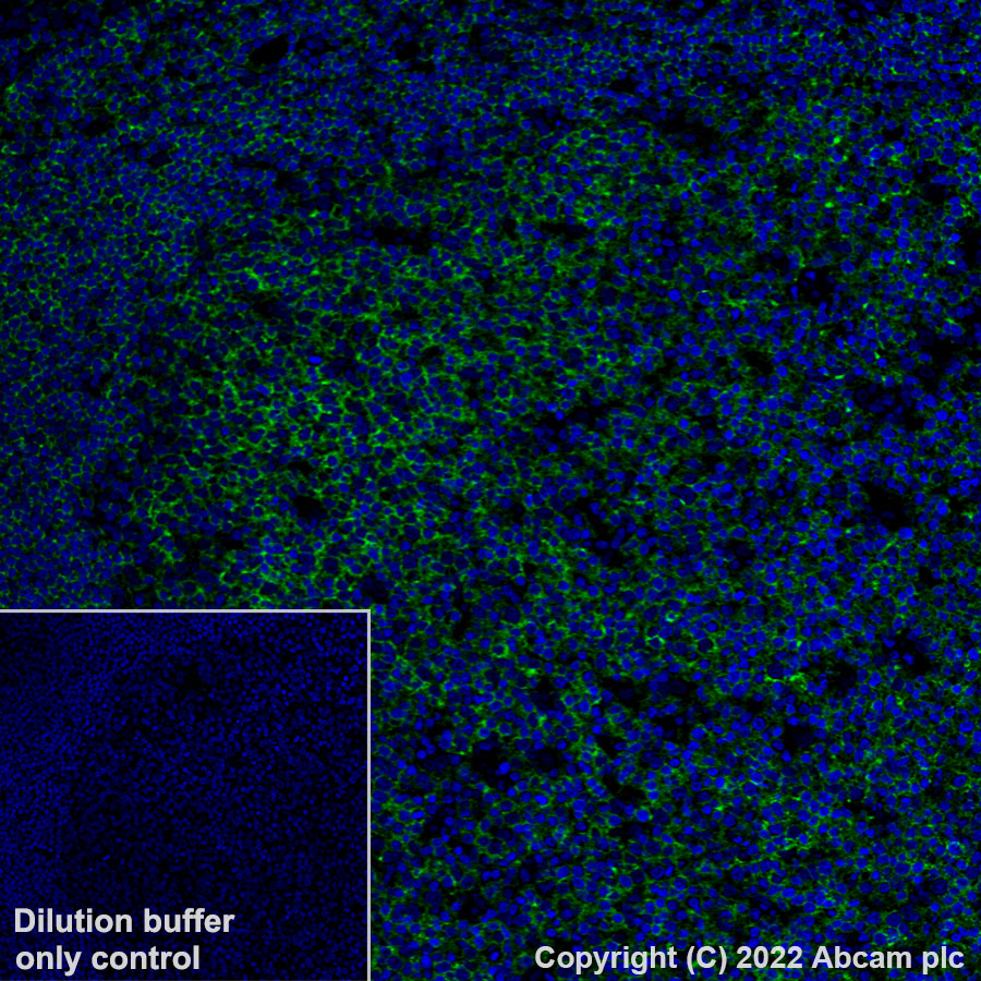 Immunohistochemistry (Formalin/PFA-fixed paraffin-embedded sections) - Alexa Fluor® 488 Anti-CD20 antibody [SP32] (AB307132), expandable thumbnail