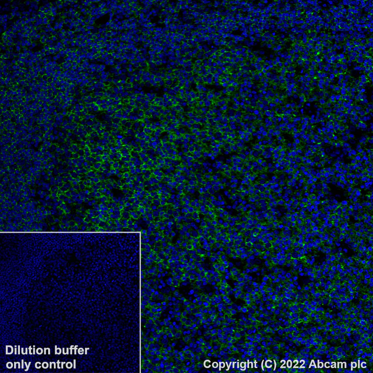 Immunohistochemistry (Formalin/PFA-fixed paraffin-embedded sections) - Alexa Fluor® 488 Anti-CD20 antibody [SP32] (AB307132)