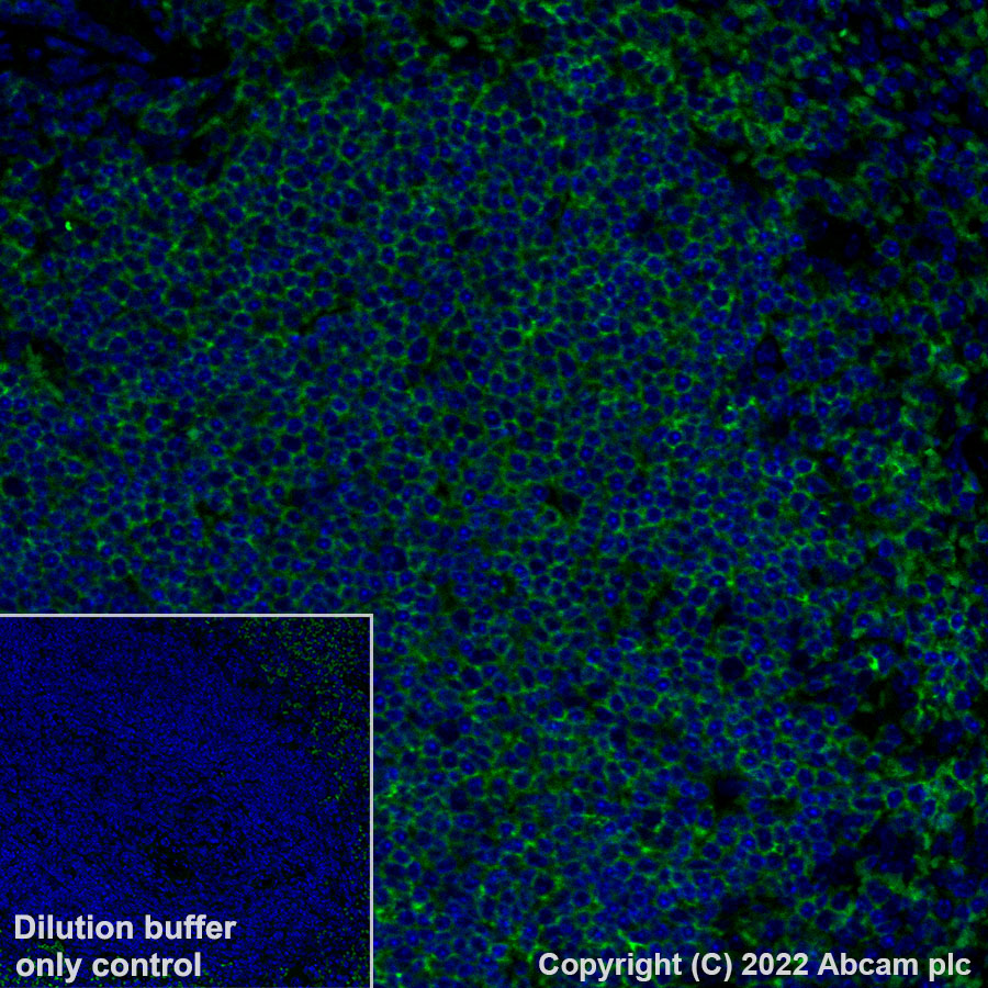 Immunohistochemistry (Formalin/PFA-fixed paraffin-embedded sections) - Alexa Fluor® 488 Anti-CD20 antibody [SP32] (AB307132), expandable thumbnail