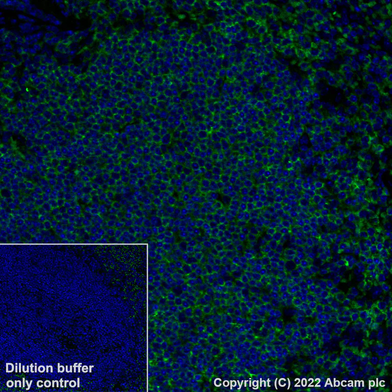 Immunohistochemistry (Formalin/PFA-fixed paraffin-embedded sections) - Alexa Fluor® 488 Anti-CD20 antibody [SP32] (AB307132)