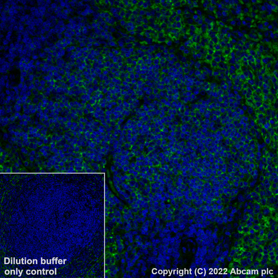 Immunohistochemistry (Formalin/PFA-fixed paraffin-embedded sections) - Alexa Fluor® 488 Anti-CD20 antibody [SP32] (AB307132), expandable thumbnail