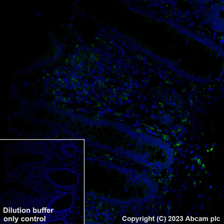 Immunohistochemistry (Formalin/PFA-fixed paraffin-embedded sections) - Alexa Fluor® 488 Anti-CD206 antibody [EPR22489-7] (AB313398)