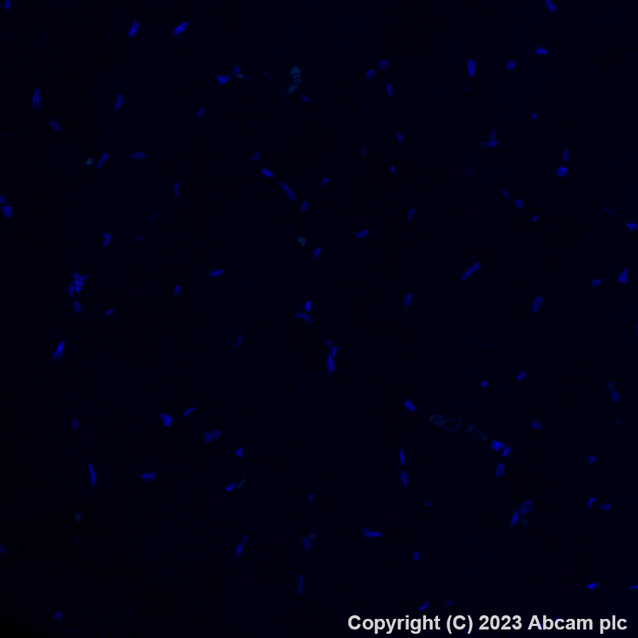 Immunohistochemistry (Formalin/PFA-fixed paraffin-embedded sections) - Alexa Fluor® 488 Anti-CD206 antibody [EPR22489-7] (AB313398)