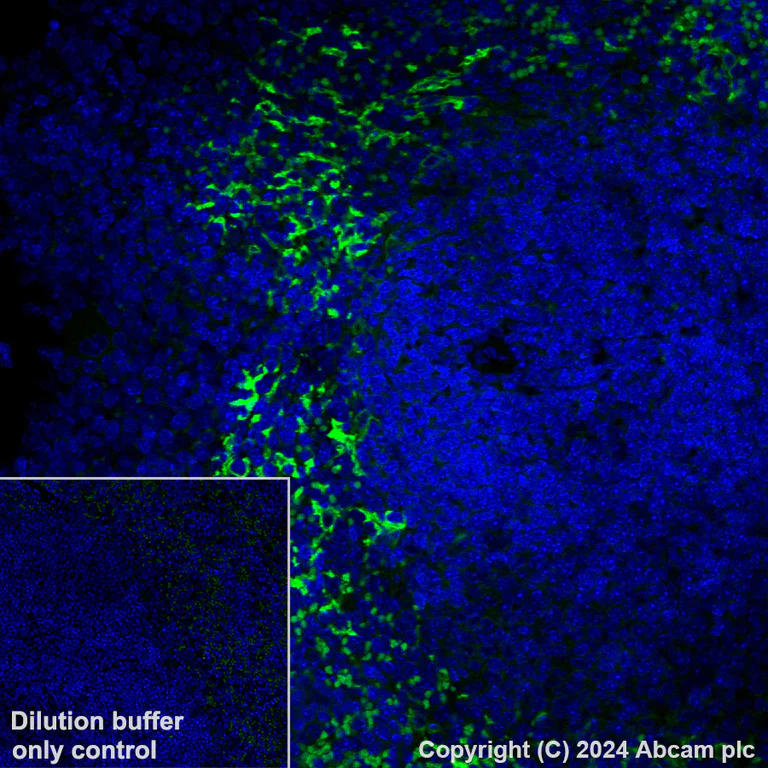 Immunohistochemistry (Formalin/PFA-fixed paraffin-embedded sections) - Alexa Fluor® 488 Anti-CD209B/DC-SIGNR1 antibody [EPR27427-87] (AB319018)