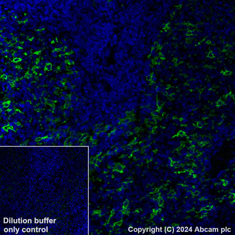 Immunohistochemistry (Formalin/PFA-fixed paraffin-embedded sections) - Alexa Fluor® 488 Anti-CD209B/DC-SIGNR1 antibody [EPR27427-87] (AB319018)