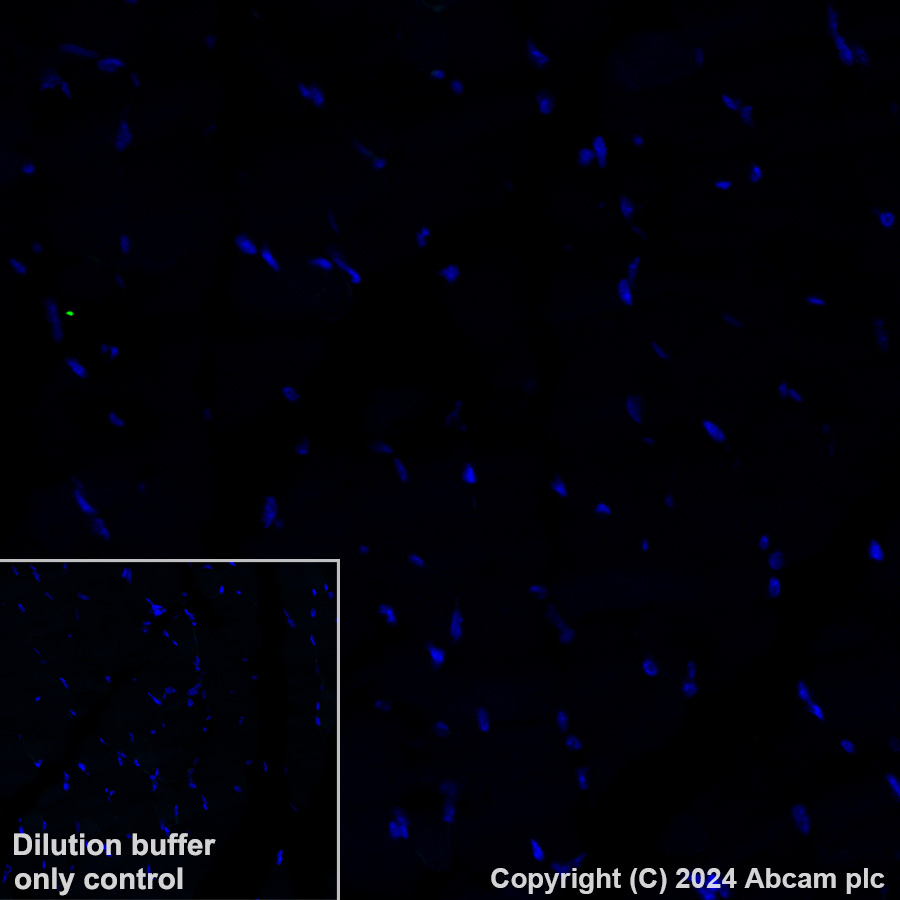 Immunohistochemistry (Formalin/PFA-fixed paraffin-embedded sections) - Alexa Fluor® 488 Anti-CD209B/DC-SIGNR1 antibody [EPR27427-87] (AB319018), expandable thumbnail