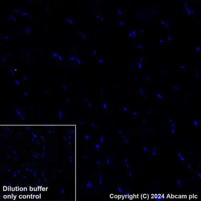 Immunohistochemistry (Formalin/PFA-fixed paraffin-embedded sections) - Alexa Fluor® 488 Anti-CD209B/DC-SIGNR1 antibody [EPR27427-87] (AB319018)