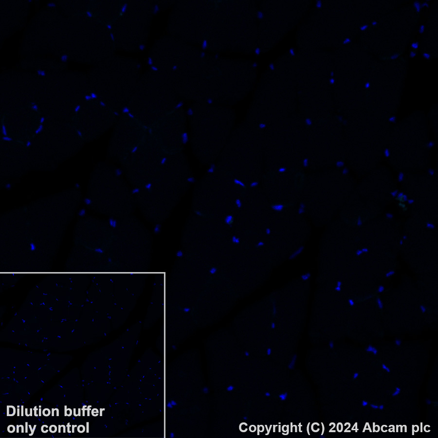 Immunohistochemistry (Formalin/PFA-fixed paraffin-embedded sections) - Alexa Fluor® 488 Anti-CD209B/DC-SIGNR1 antibody [EPR27427-87] (AB319018), expandable thumbnail