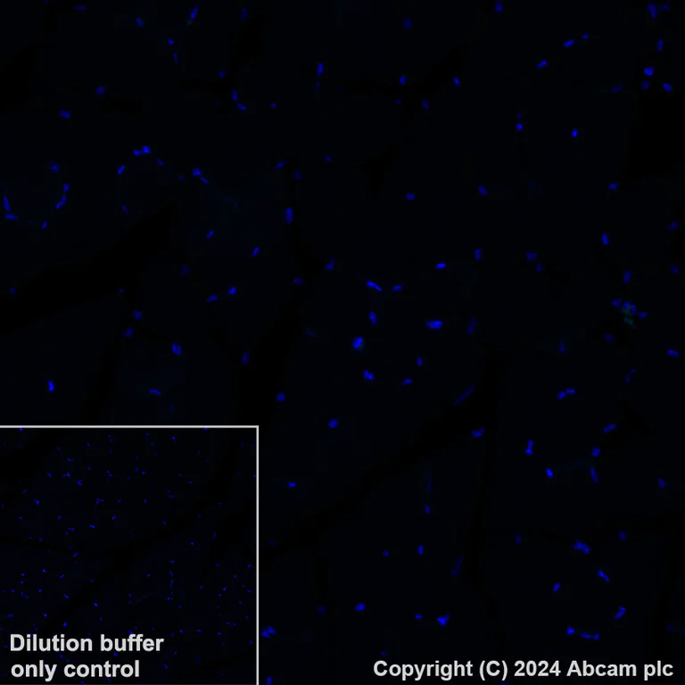 Immunohistochemistry (Formalin/PFA-fixed paraffin-embedded sections) - Alexa Fluor® 488 Anti-CD209B/DC-SIGNR1 antibody [EPR27427-87] (AB319018)