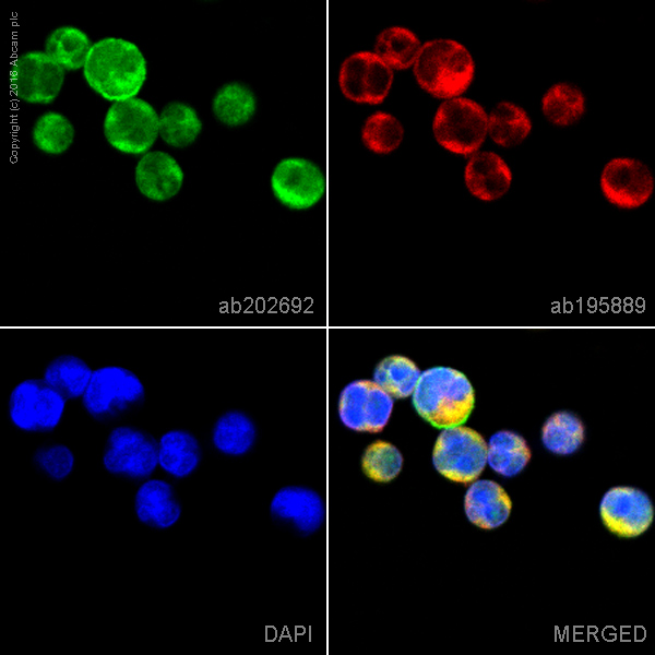 Immunocytochemistry/ Immunofluorescence - Alexa Fluor® 488 Anti-CD21 antibody [EP3093] (AB202692)