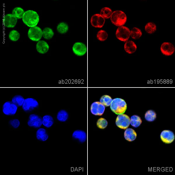 Immunocytochemistry/ Immunofluorescence - Alexa Fluor® 488 Anti-CD21 antibody [EP3093] (AB202692)