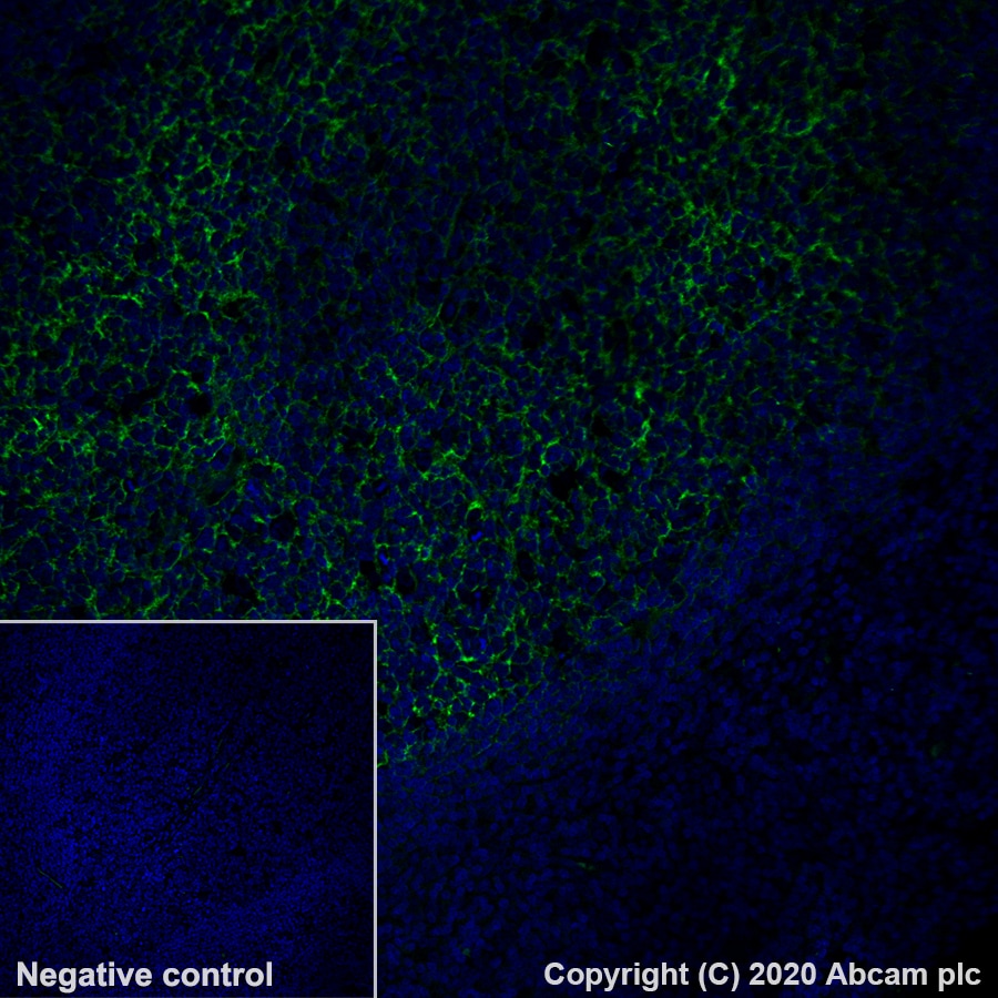 Immunohistochemistry (Formalin/PFA-fixed paraffin-embedded sections) - Alexa Fluor® 488 Anti-CD21 antibody [EP3093] (AB202692)