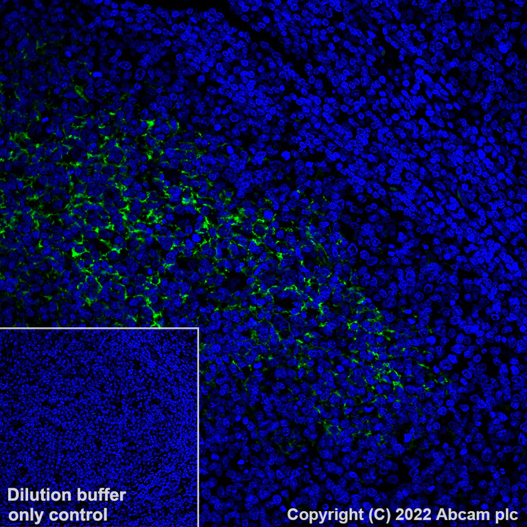 Immunohistochemistry (Formalin/PFA-fixed paraffin-embedded sections) - Alexa Fluor® 488 Anti-CD23 antibody [EPR3617] (AB305270)