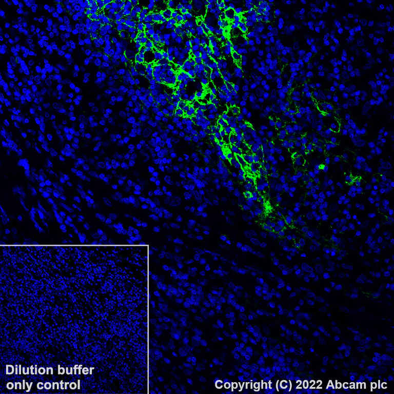 Immunohistochemistry (Formalin/PFA-fixed paraffin-embedded sections) - Alexa Fluor® 488 Anti-CD23 antibody [EPR3617] (AB305270)