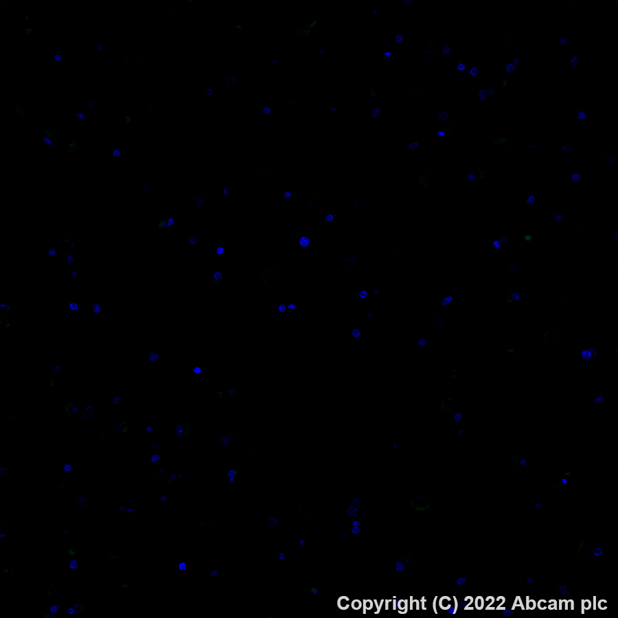 Immunohistochemistry (Formalin/PFA-fixed paraffin-embedded sections) - Alexa Fluor® 488 Anti-CD3 antibody [SP162] (AB307134), expandable thumbnail
