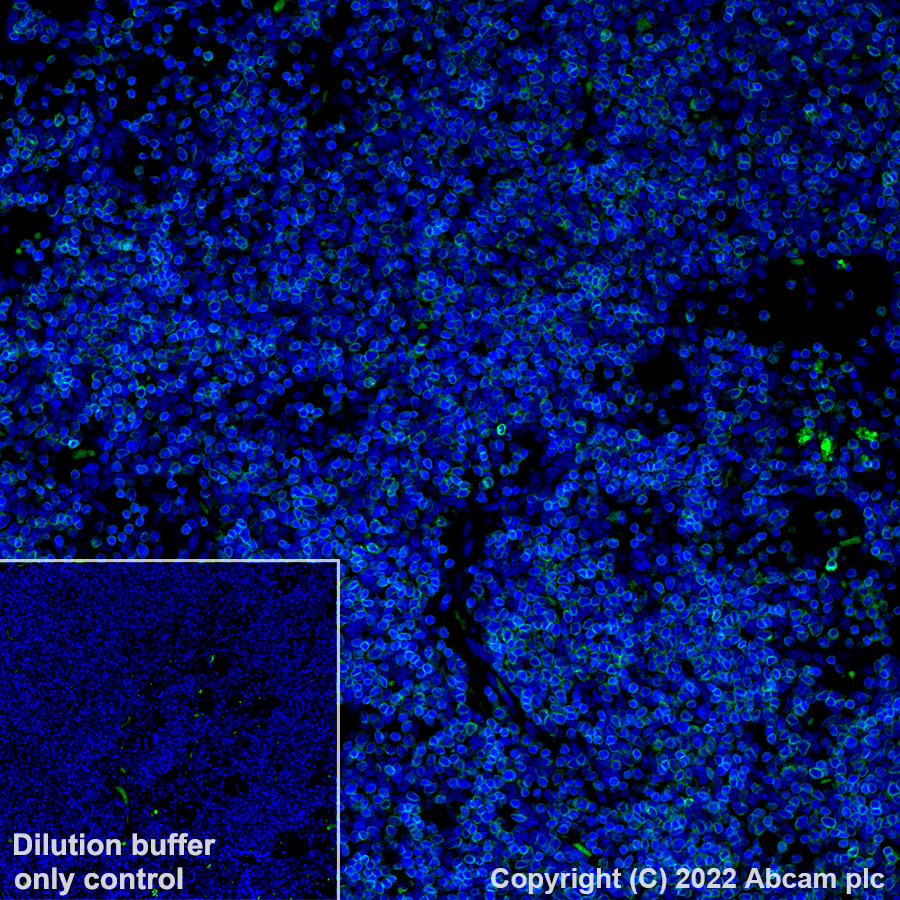 Immunohistochemistry (Formalin/PFA-fixed paraffin-embedded sections) - Alexa Fluor® 488 Anti-CD3 antibody [SP162] (AB307134), expandable thumbnail