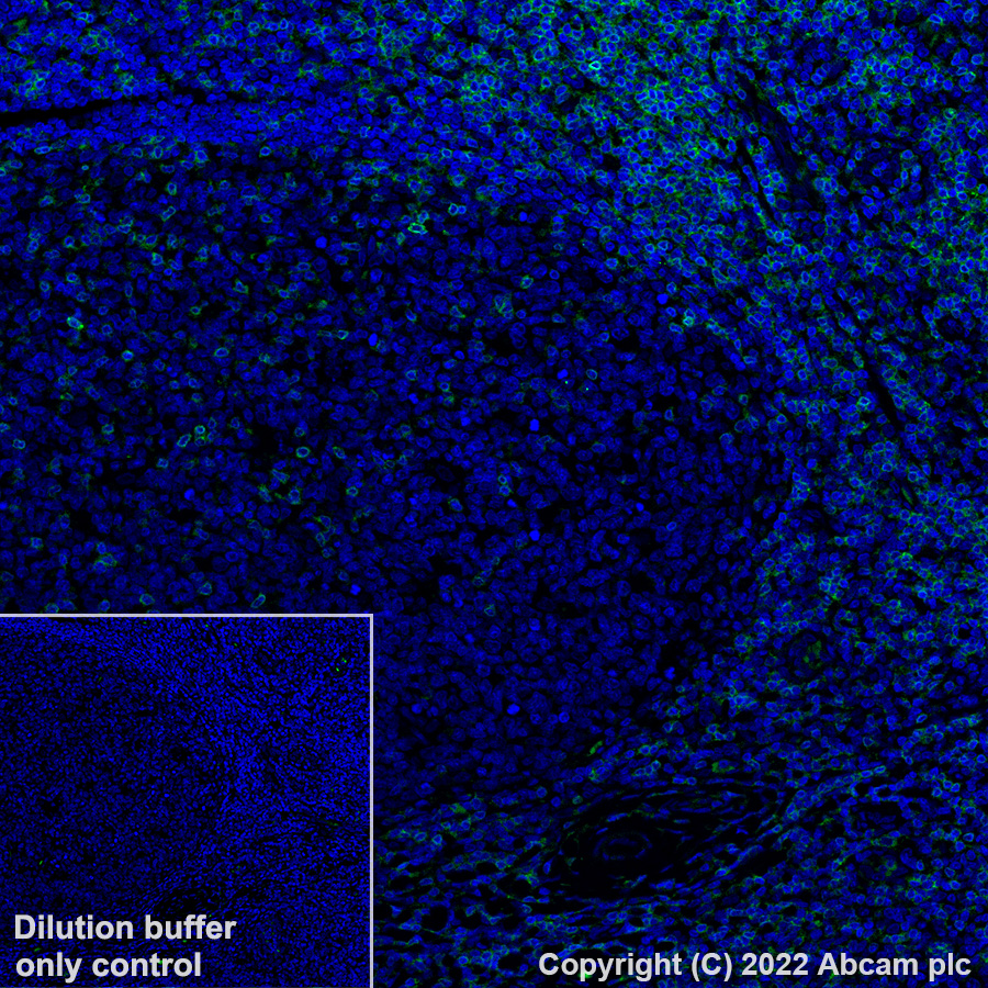 Immunohistochemistry (Formalin/PFA-fixed paraffin-embedded sections) - Alexa Fluor® 488 Anti-CD3 antibody [SP162] (AB307134), expandable thumbnail