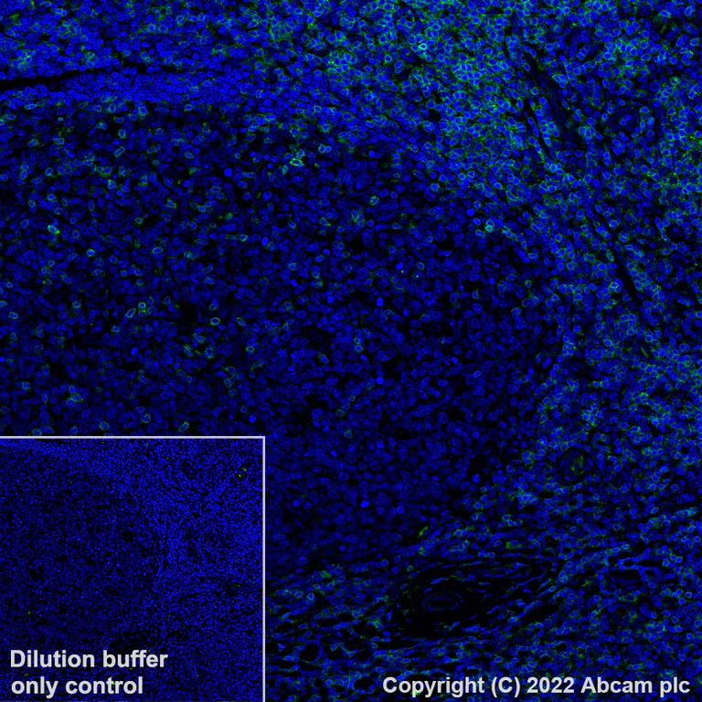 Immunohistochemistry (Formalin/PFA-fixed paraffin-embedded sections) - Alexa Fluor® 488 Anti-CD3 antibody [SP162] (AB307134)