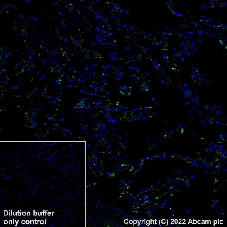 Immunohistochemistry (Formalin/PFA-fixed paraffin-embedded sections) - Alexa Fluor® 488 Anti-CD31 antibody [EPR17259] (AB305267)