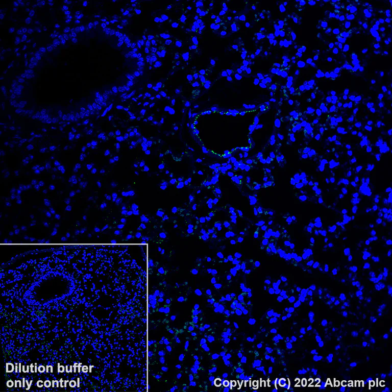 Immunohistochemistry (Formalin/PFA-fixed paraffin-embedded sections) - Alexa Fluor® 488 Anti-CD31 antibody [EPR17259] (AB305267)