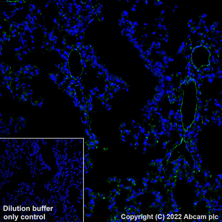 Immunohistochemistry (Formalin/PFA-fixed paraffin-embedded sections) - Alexa Fluor® 488 Anti-CD31 antibody [EPR17259] (AB305267)