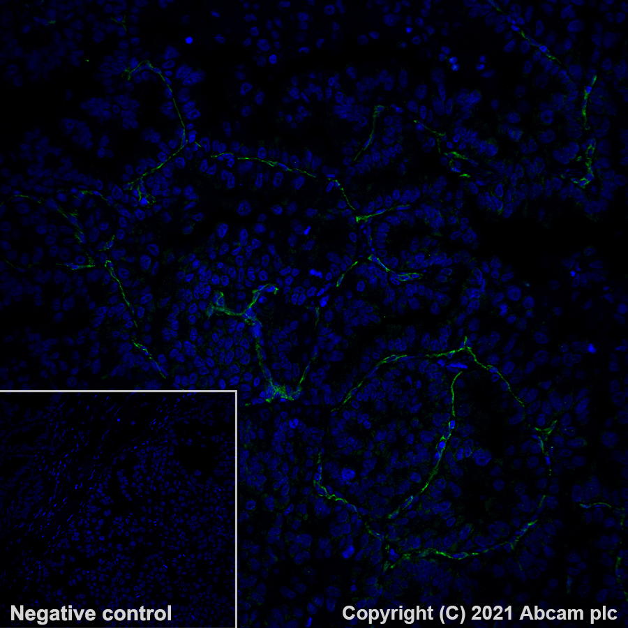 Immunohistochemistry (Formalin/PFA-fixed paraffin-embedded sections) - Alexa Fluor® 488 Anti-CD31 antibody [EPR3094] (AB275989), expandable thumbnail